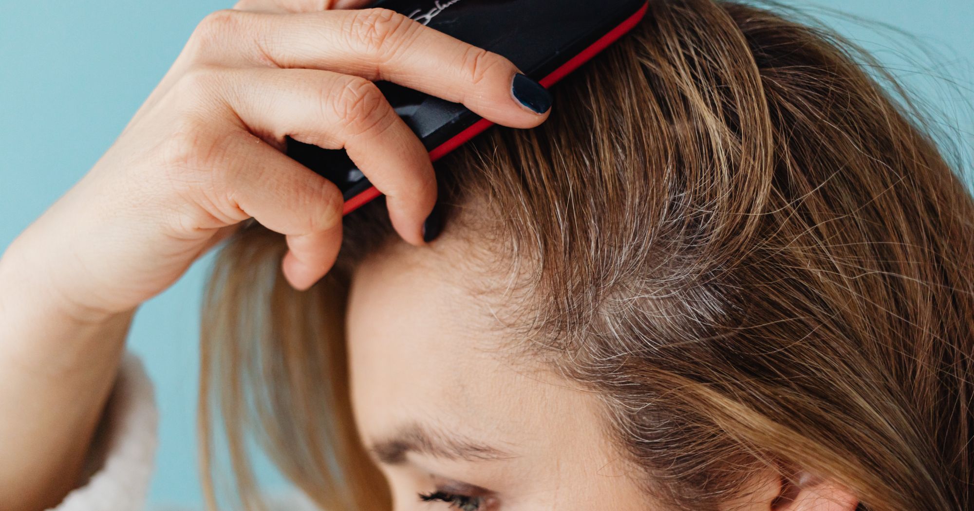 Best Non-Surgical Hair Restoration Treatments for Thinning Hair in Atlanta