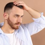 Can You Restore a Receding Hairline Without Surgery