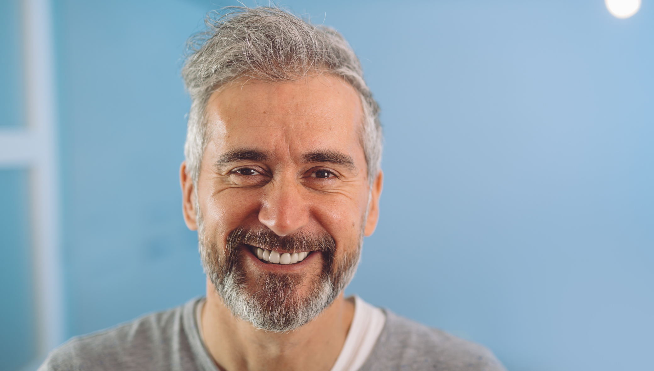 Is Hair Transplant Covered by Insurance?