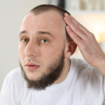 Hair Restoration for Men in Atlanta