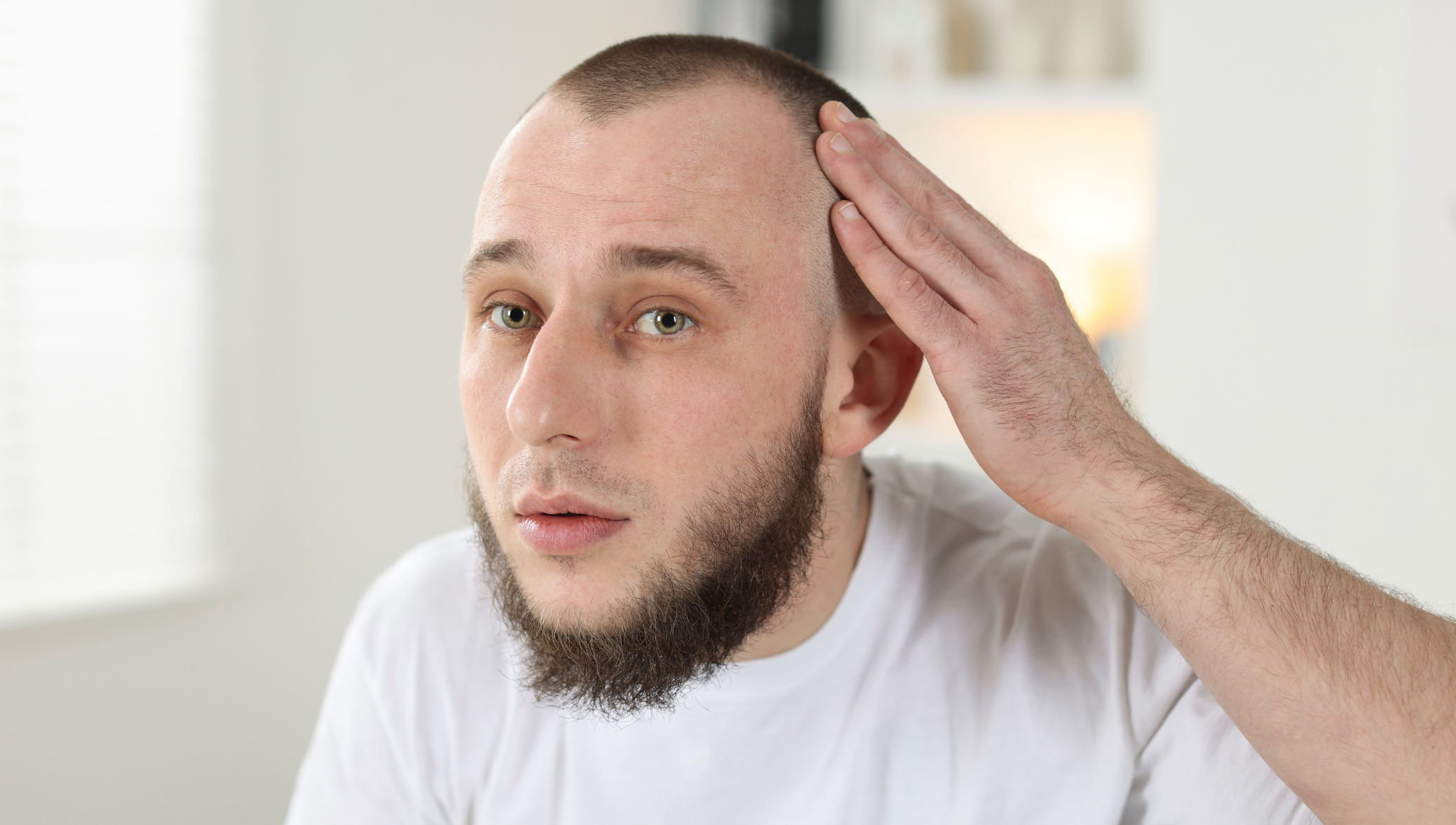 Hair Restoration for Men in Atlanta