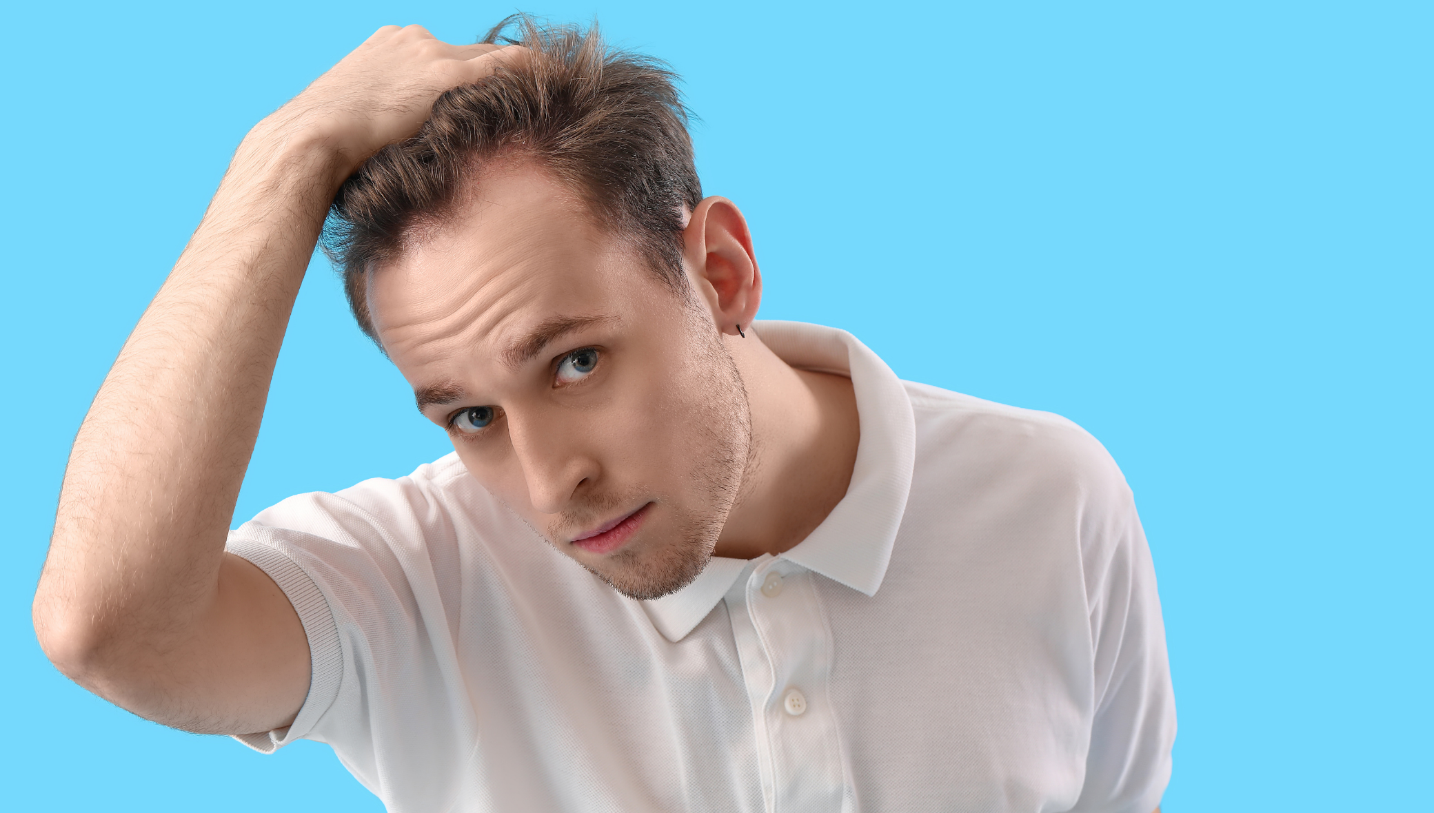 microneedling for hair restoration