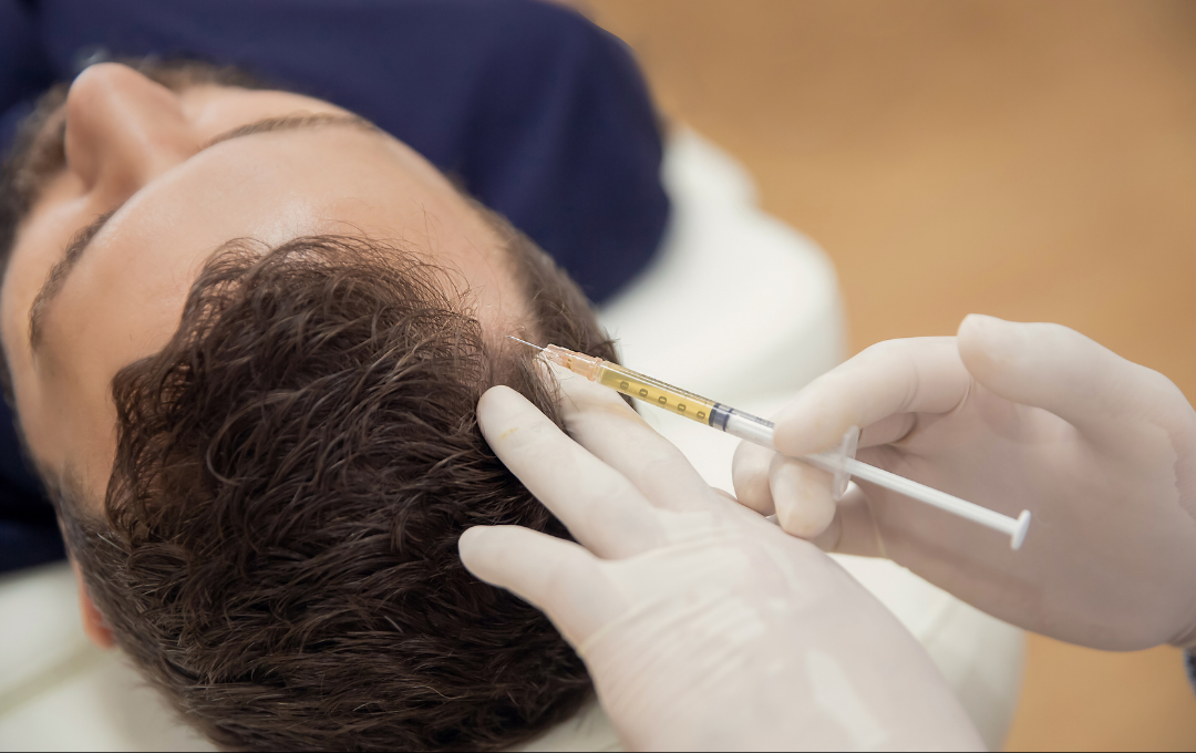 PRP hair treatment Atlanta