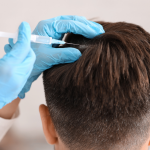 PRP hair treatment for men Atlanta